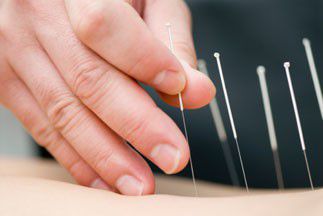 comment devenir acupuncteur